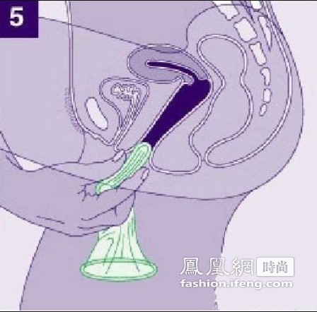 揭秘女用避孕套的使用步骤(组图)