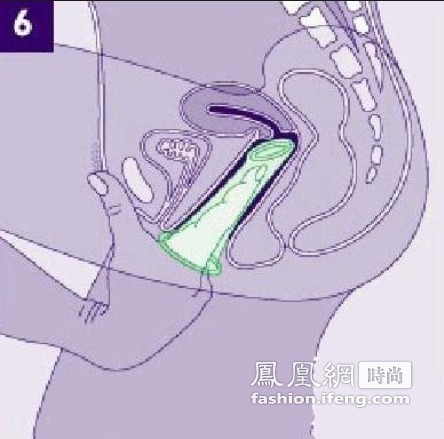 揭秘女用避孕套的使用步骤(组图)