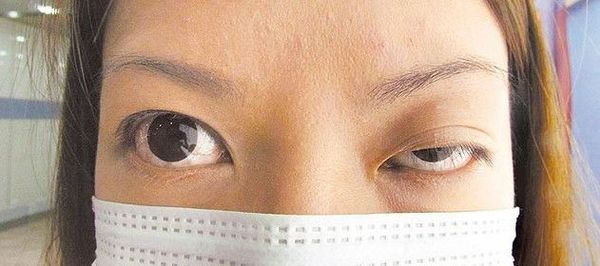 台湾新娘打肉毒素破相 婚宴改成化妆舞会(图)